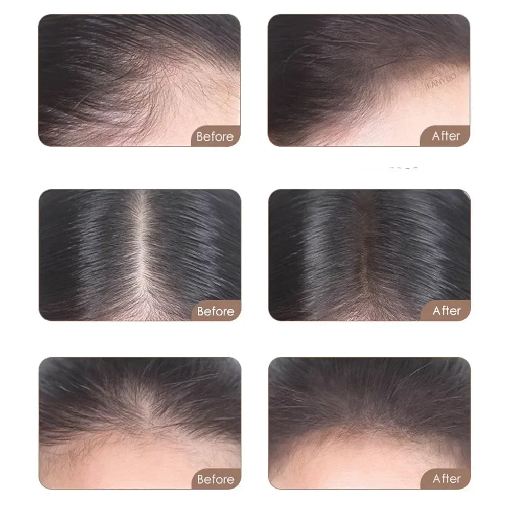 Hairline Filler Makeup for White and Thinning Hair