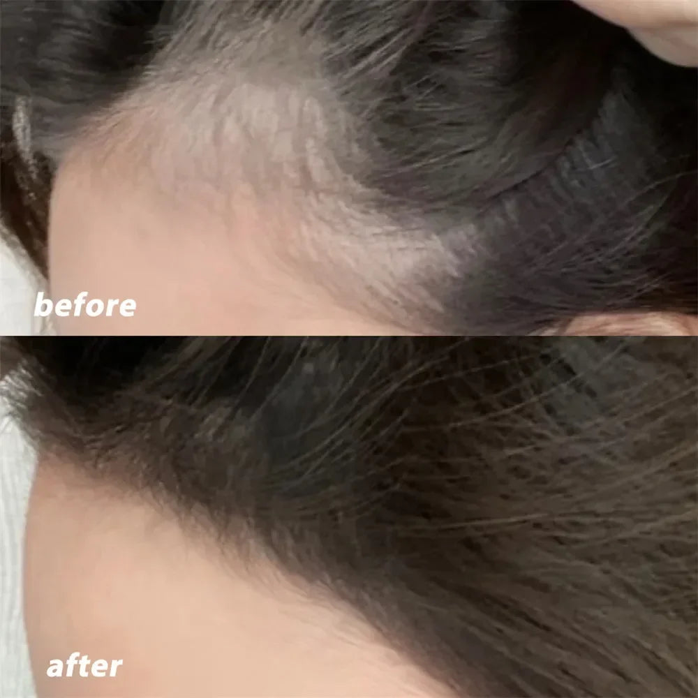 Hairline Filler Makeup for White and Thinning Hair