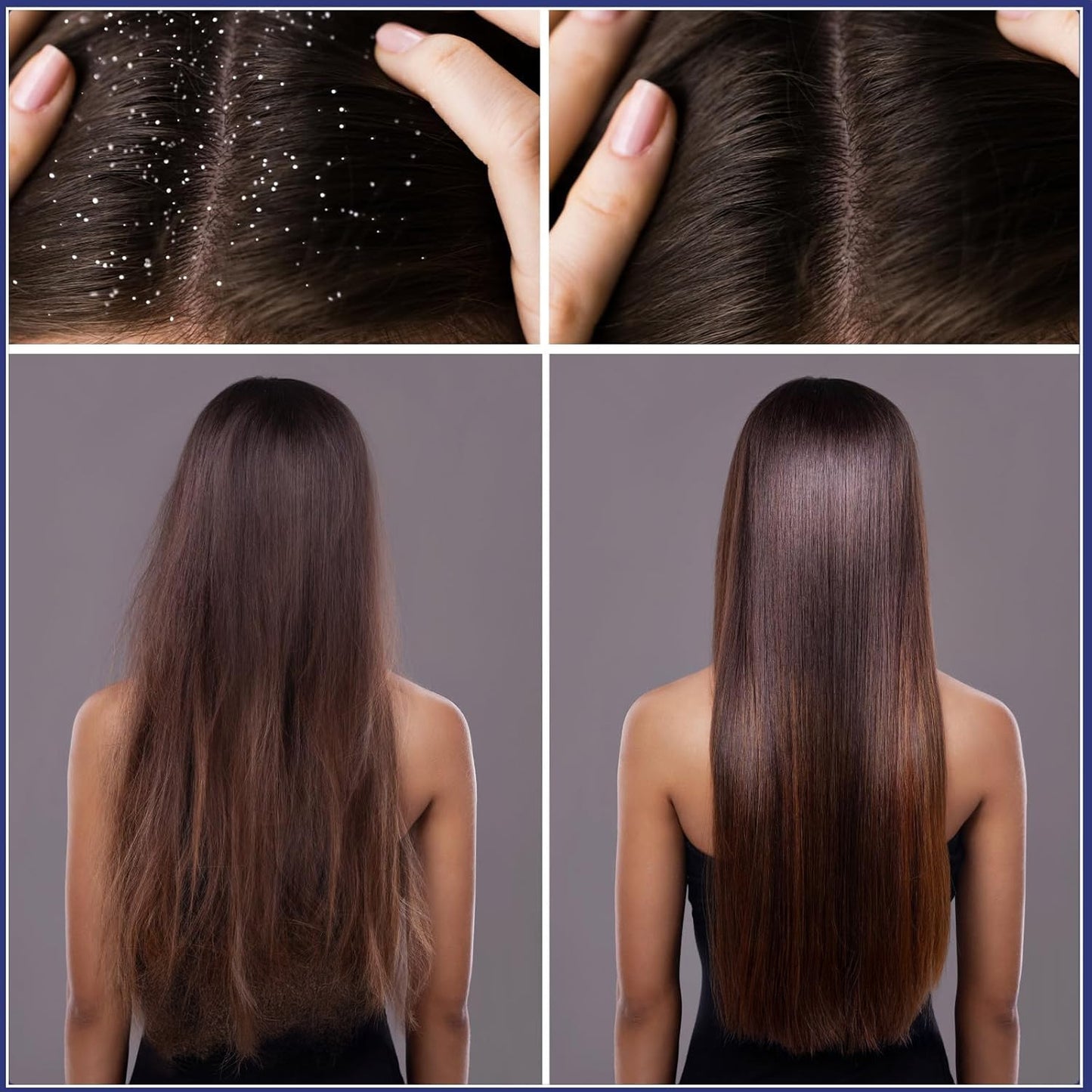 Revita Scalp — Growth & Strength Brush