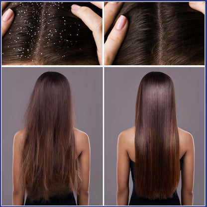 Revita Scalp — Growth & Strength Brush