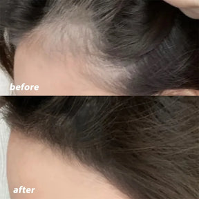 Hairline Filler Makeup for White and Thinning Hair